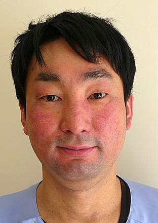 国立病院機構 鳥取医療センター 岡田　雅人さん